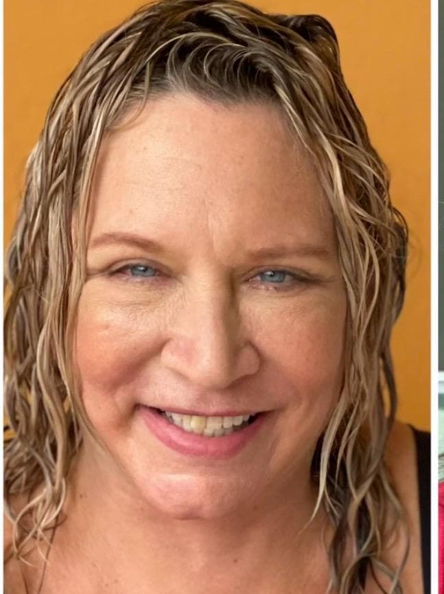Lifting Facial - Resultado